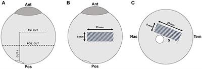 Changes in Vitreoretinal Adhesion With Age and Region in Human and Sheep Eyes